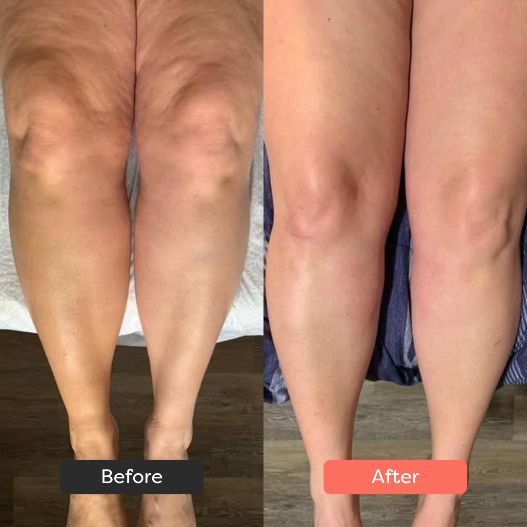 SlimSculpt™ Device - Target Fat. Tone Fast.