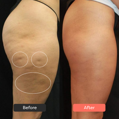 SlimSculpt™ Device - Target Fat. Tone Fast.