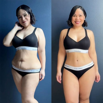 SlimSculpt™ Device - Target Fat. Tone Fast.