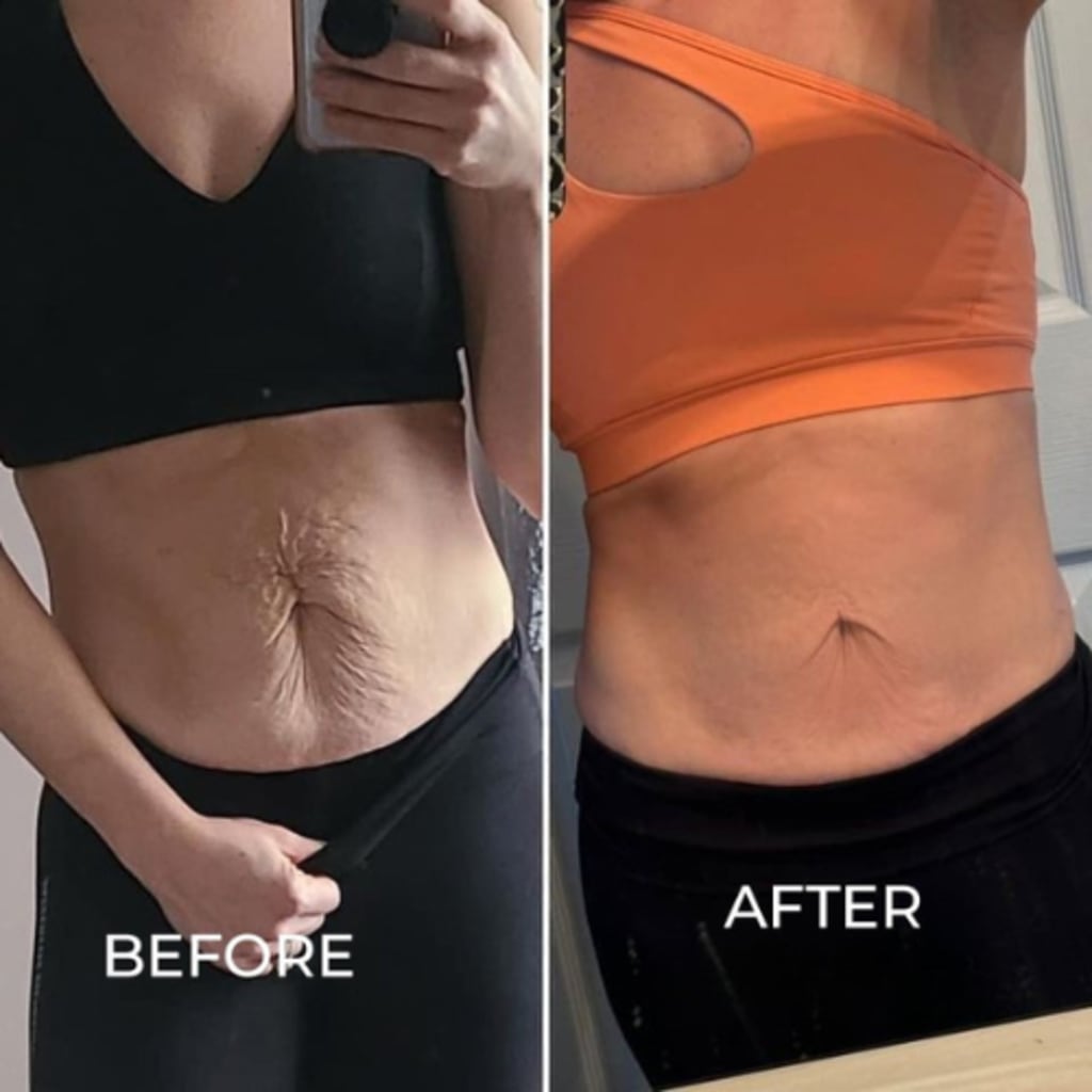 SlimSculpt™ Device - Target Fat. Tone Fast.